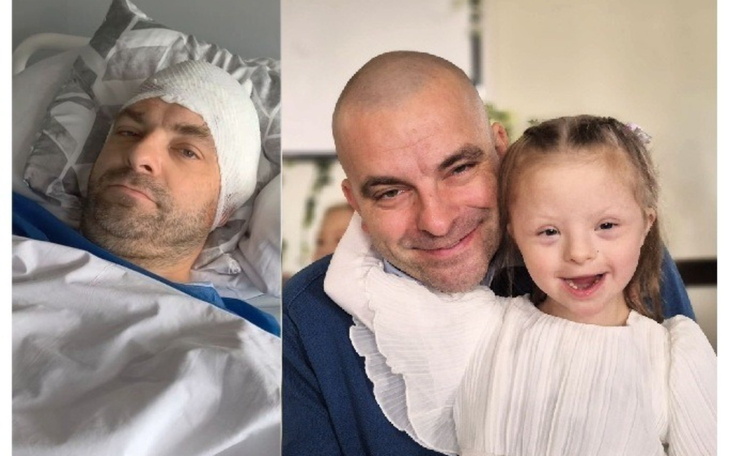 Na zdjęciach Filip Rodzik. Po lewej mężczyzna w szpitalu z opatrunkiem na głowie. Po prawej ten sam mężczyzna z małą uśmiechniętą dziewczynką
