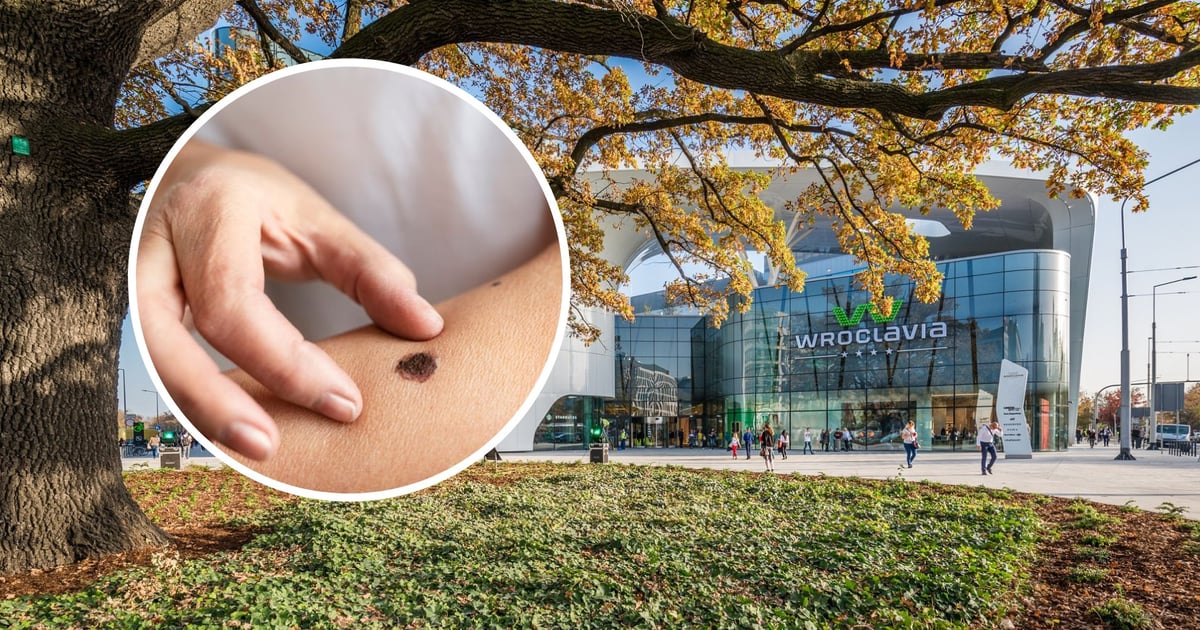 Zbadaj bezpłatnie swoje znamiona! W czwartek pod Wroclavią stanie dermobus