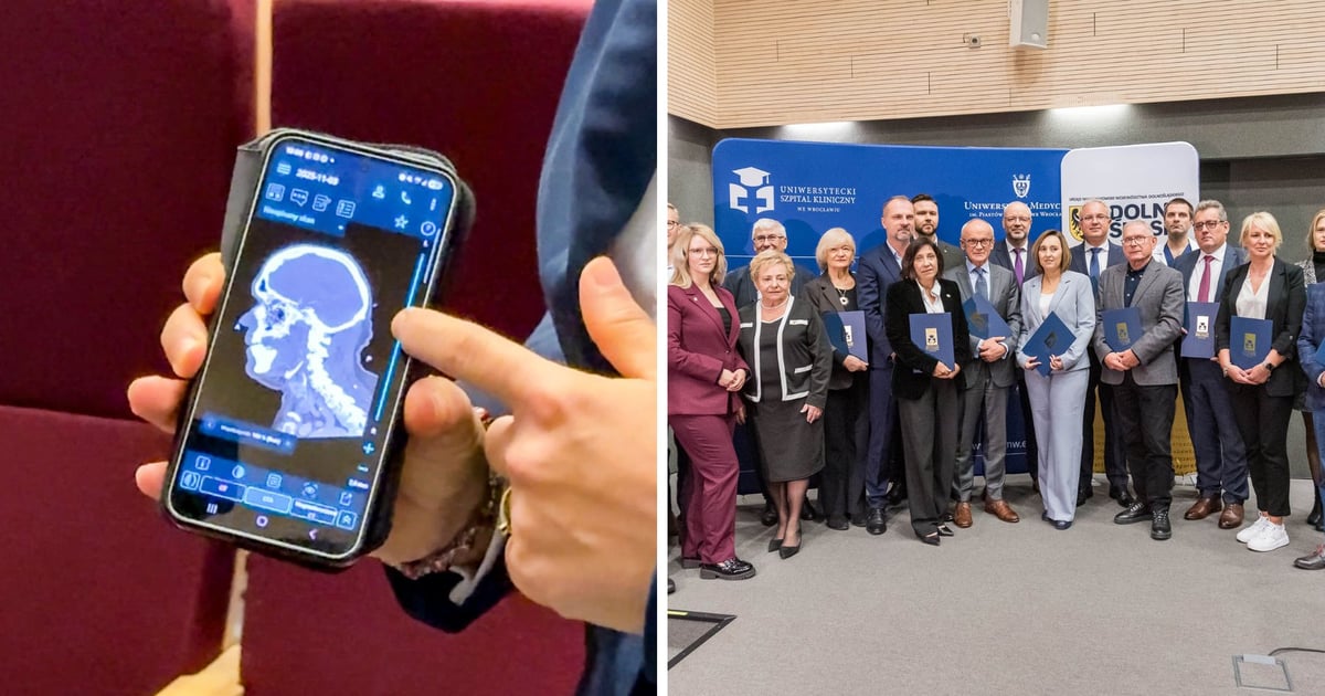 12 dolnośląskich szpitali będzie szybciej diagnozować i leczyć udary