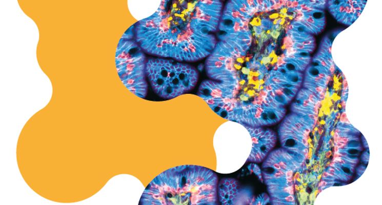 Plakat PORT for Health: Oncology 2026