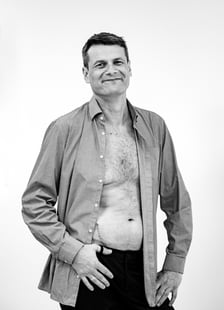 Na zdjęciu pacjent po przeszczepie nerki od dawcy zmarłego (ok. dwa miesiące temu)