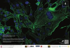 <p>Kom&oacute;rki fibroblast&oacute;w</p>
