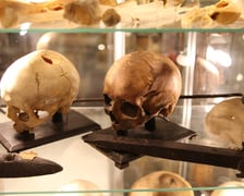 Muzeum Medycyny Sądowej we Wrocławiu, ekspozycja