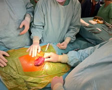 Operacja jednoczesnej retransplantacji serca i przeszczepu nerki