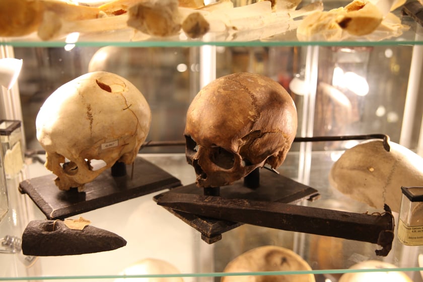 Muzeum Medycyny Sądowej we Wrocławiu, ekspozycja