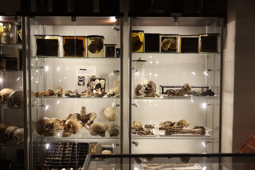 Muzeum Medycyny Sądowej Uniwersytetu Medycznego we Wrocławiu