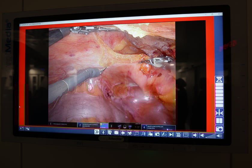 Operacja z udziałem robota da Vinci w USK we Wrocławiu