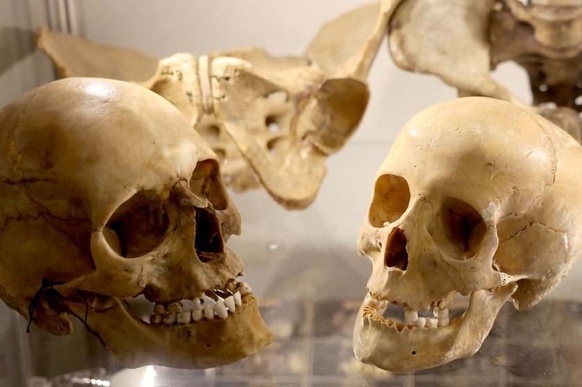 Czaszki w Muzeum Medycyny Sądowej we Wrocławiu
