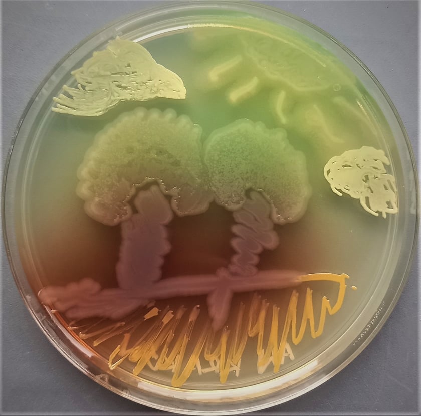 Prace wykonane bakteriami