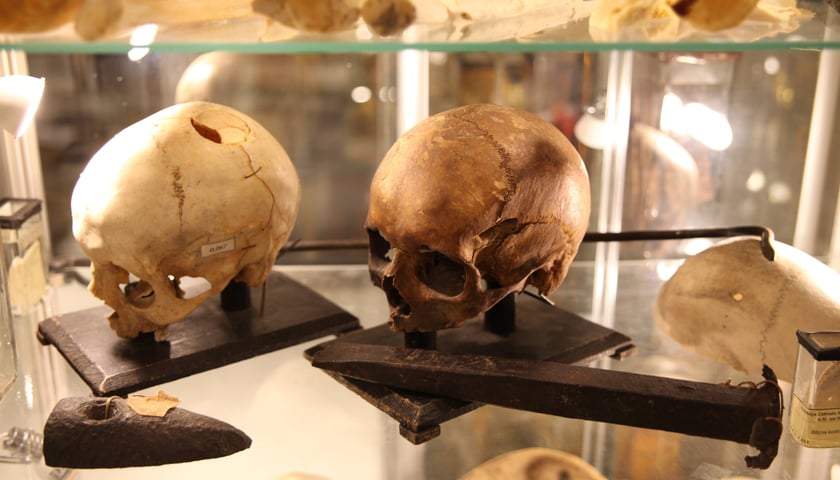 Muzeum Medycyny Sądowej we Wrocławiu, ekspozycja