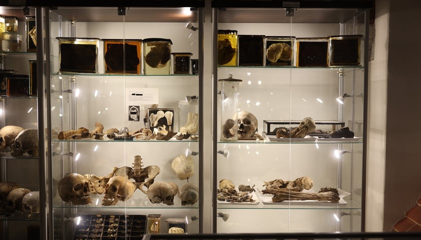 Muzeum Medycyny Sądowej Uniwersytetu Medycznego we Wrocławiu