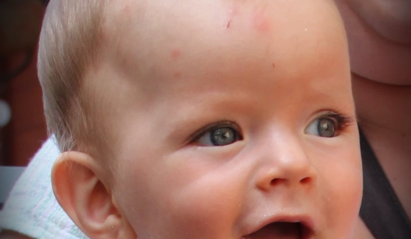 Pomóż Kacperkowi lepiej słyszeć