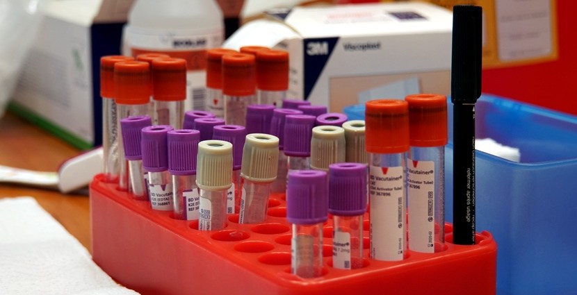 Zadbaj o swoje zdrowie i weź udział w darmowych badaniach Biobanku PORT