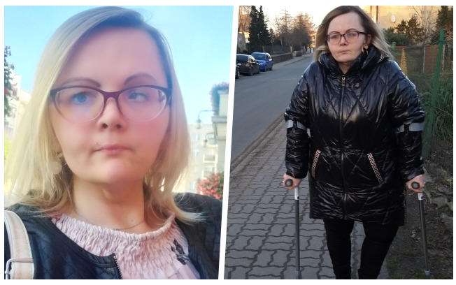 Na zdjęciach Edyta Woźniak, 36-letnia mieszkanka Strzegomia, która potrzebuje kosztownej operacji, aby odzyskać sprawność