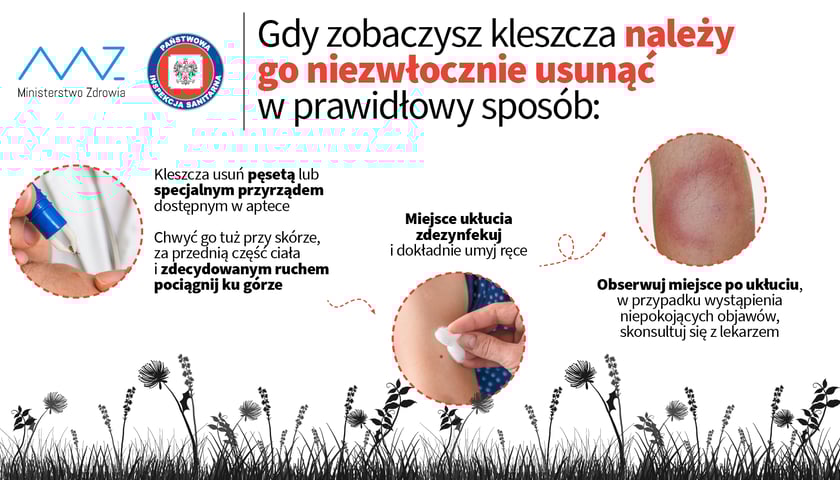 Tablica: jak usunąć kleszcza