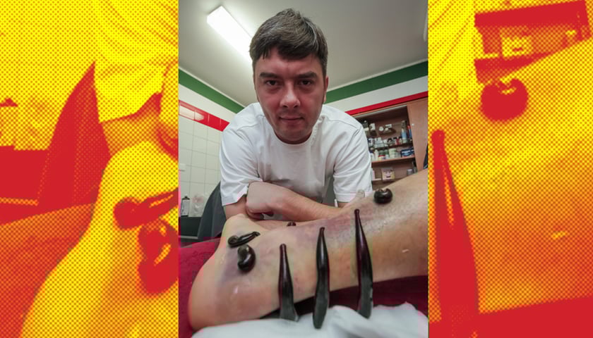 Pijawki w służbie sportu [WIDEO]