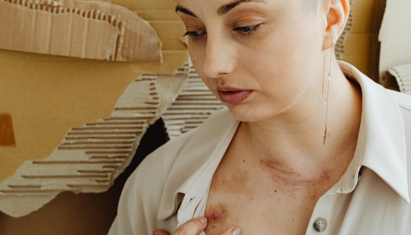 <p>Kobiety często wstydzą się pokazać swoje obrażenia na obdukcji lekarskiej i rezygnują z pr&oacute;b poszukiwania pomocy</p>