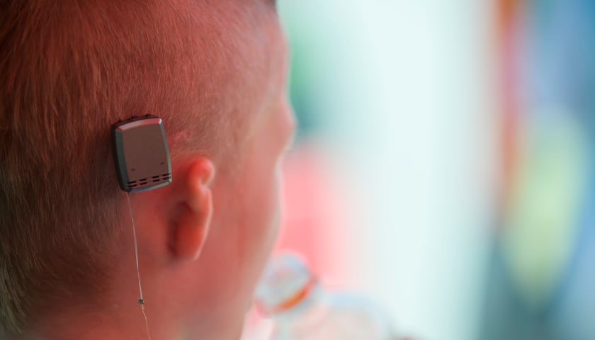 Pierwsi pacjenci z implantami Bacha