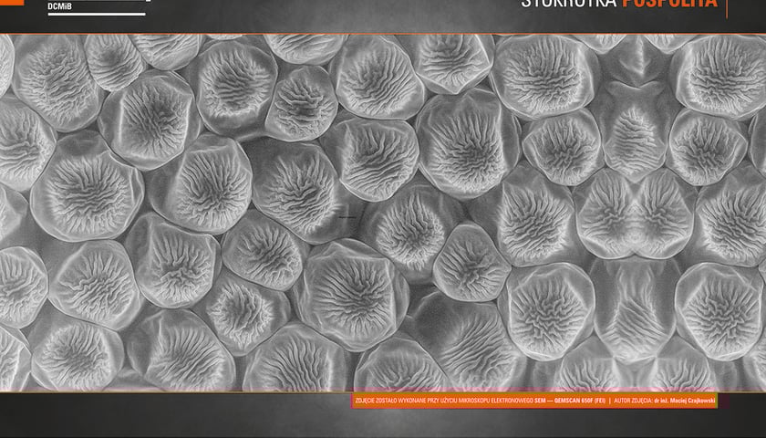 Galeria Fotografii EIT+: Obrazy spod mikroskopu