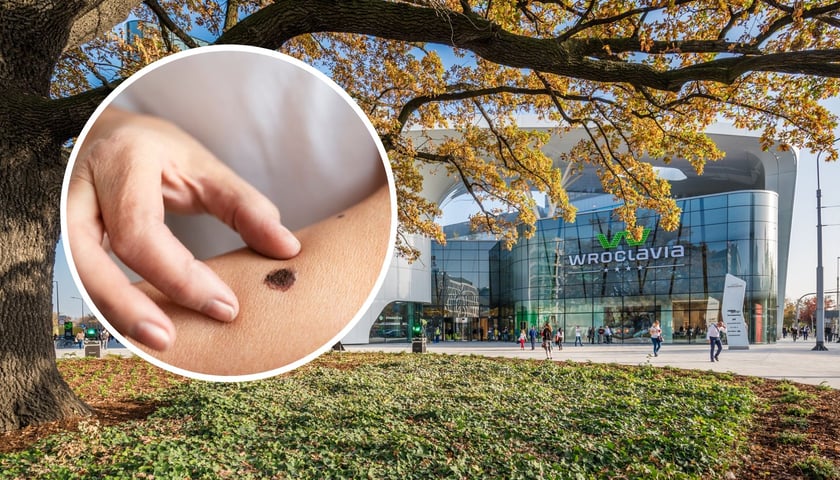 W tle: galeria Wroclavia, w kółku: znamię skórne