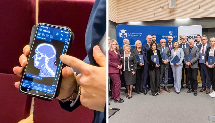 12 dolnośląskich szpitali połączyło siły. Razem będą szybciej diagnozować udary i je leczyć