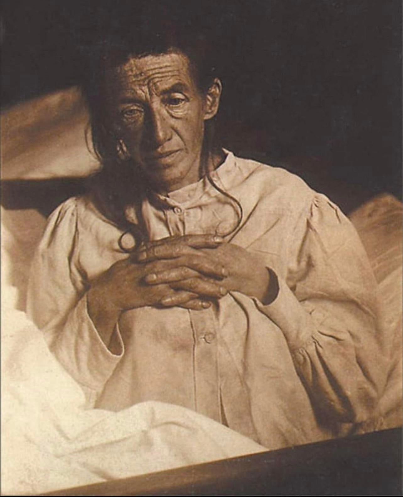 pacjentka Alzheimera